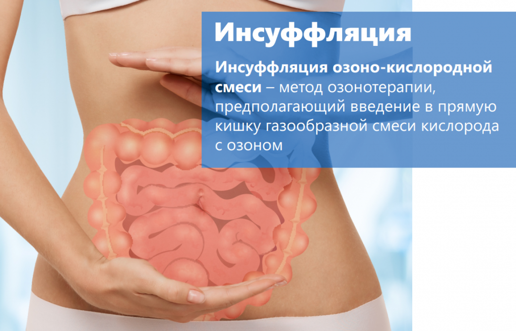 инсуфляция озоном с текстом.jpg инсуфляция озоном с текстом.jpg